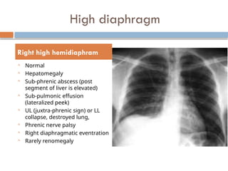 Chest X Ray interpretation Felson radiology.pptx