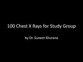 100 Chest X Rays for Study Group

        by Dr. Suneet Khurana
 