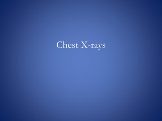 Chest X-rays
 