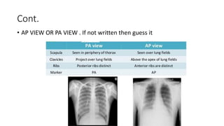 Chest xrays how to interpret. photos | PPTX
