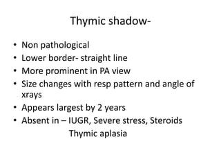 Chest xrays | PPTX