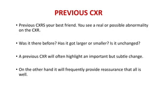 PREVIOUS CXR
• Previous CXRS your best friend. You see a real or possible abnormality
on the CXR.
• Was it there before? Has it got larger or smaller? Is it unchanged?
• A previous CXR will often highlight an important but subtle change.
• On the other hand it will frequently provide reassurance that all is
well.
 