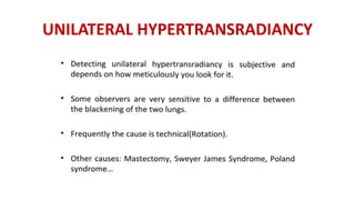 UNILATERAL HYPERTRANSRADIANCY
 
