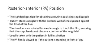 Posterior-anterior (PA) Position
• The standard position for obtaining a routine adult chest radiograph
• Patient stands upright with the anterior wall of chest placed against
the front of the film
• The shoulders are rotated forward enough to touch the film, ensuring
that the scapulae do not obscure a portion of the lung field
• Usually taken with the patient in full inspiration
• The PA film is viewed as if the patient is standing in front of you
 