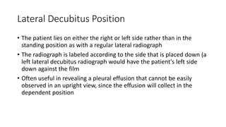 Lateral Decubitus Position
• The patient lies on either the right or left side rather than in the
standing position as with a regular lateral radiograph
• The radiograph is labeled according to the side that is placed down (a
left lateral decubitus radiograph would have the patient's left side
down against the film
• Often useful in revealing a pleural effusion that cannot be easily
observed in an upright view, since the effusion will collect in the
dependent position
 