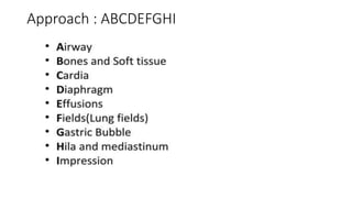 Approach : ABCDEFGHI
 