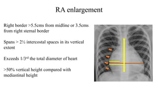 RA enlargement
Right border >5.5cms from midline or 3.5cms
from right sternal border
Spans > 2½ intercostal spaces in its vertical
extent
Exceeds 1/3rd the total diameter of heart
>50% vertical height compared with
mediastinal height
 