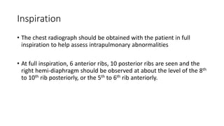 Inspiration
• The chest radiograph should be obtained with the patient in full
inspiration to help assess intrapulmonary abnormalities
• At full inspiration, 6 anterior ribs, 10 posterior ribs are seen and the
right hemi-diaphragm should be observed at about the level of the 8th
to 10th rib posteriorly, or the 5th to 6th rib anteriorly.
 