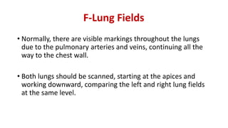 F-Lung Fields
• Normally, there are visible markings throughout the lungs
due to the pulmonary arteries and veins, continuing all the
way to the chest wall.
• Both lungs should be scanned, starting at the apices and
working downward, comparing the left and right lung fields
at the same level.
 