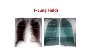 F-Lung Fields
 
