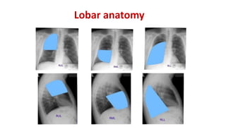 Lobar anatomy
 