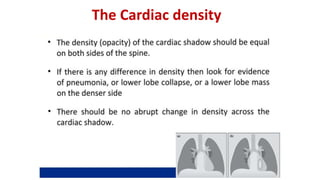 The Cardiac density
 