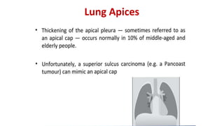 Lung Apices
 