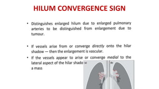 HILUM CONVERGENCE SIGN
 