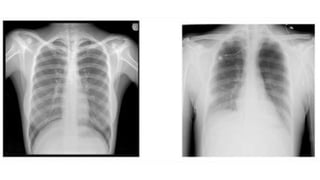Chest X rays.pptx