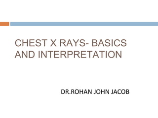 CHEST X RAYS- BASICS
AND INTERPRETATION
DR.ROHAN JOHN JACOB
 