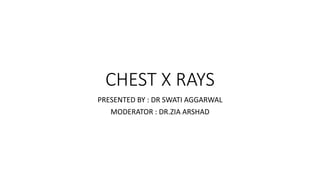 CHEST X RAYS
PRESENTED BY : DR SWATI AGGARWAL
MODERATOR : DR.ZIA ARSHAD
 