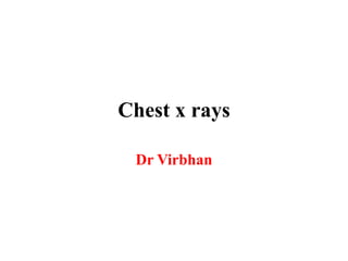 Chest x rays
Dr Virbhan
 
