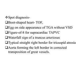 Spot diagnosis-
Boot-shaped heart- TOF,
Egg on side appearance of TGA without VSD
Figure-of-8 for supracardiac TAPVC
Waterfall sign of a truncus arteriosus
Typical straight right border for tricuspid atresia
Aorta forming the left border in corrected
transposition of great vessels.
 
