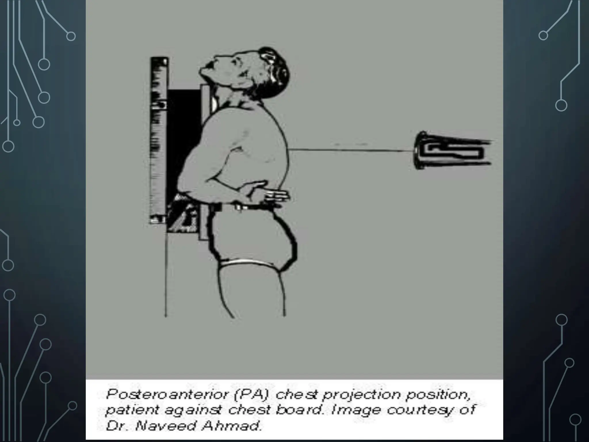 basic-chest-x-ray-views-ap-pa-lateral-etc-pptx-pptx