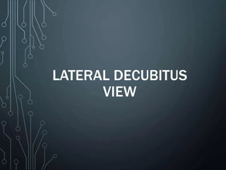 LATERAL DECUBITUS
VIEW
 