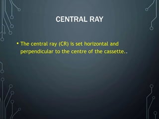 CENTRAL RAY
• The central ray (CR) is set horizontal and
perpendicular to the centre of the cassette..
 