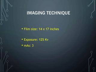 IMAGING TECHNIQUE
• Film size: 14 x 17 inches
• Exposure: 125 Kv
• mAs: 3
 