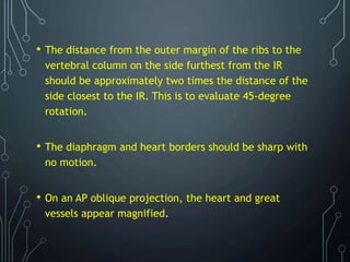 • The distance from the outer margin of the ribs to the
vertebral column on the side furthest from the IR
should be approximately two times the distance of the
side closest to the IR. This is to evaluate 45-degree
rotation.
• The diaphragm and heart borders should be sharp with
no motion.
• On an AP oblique projection, the heart and great
vessels appear magnified.
 