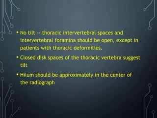 • No tilt -- thoracic intervertebral spaces and
intervertebral foramina should be open, except in
patients with thoracic deformities.
• Closed disk spaces of the thoracic vertebra suggest
tilt
• Hilum should be approximately in the center of
the radiograph
 