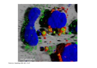 VHC génotype 1b
Piodi et al., Hepatology 2008, 48(1): 16-27.
 