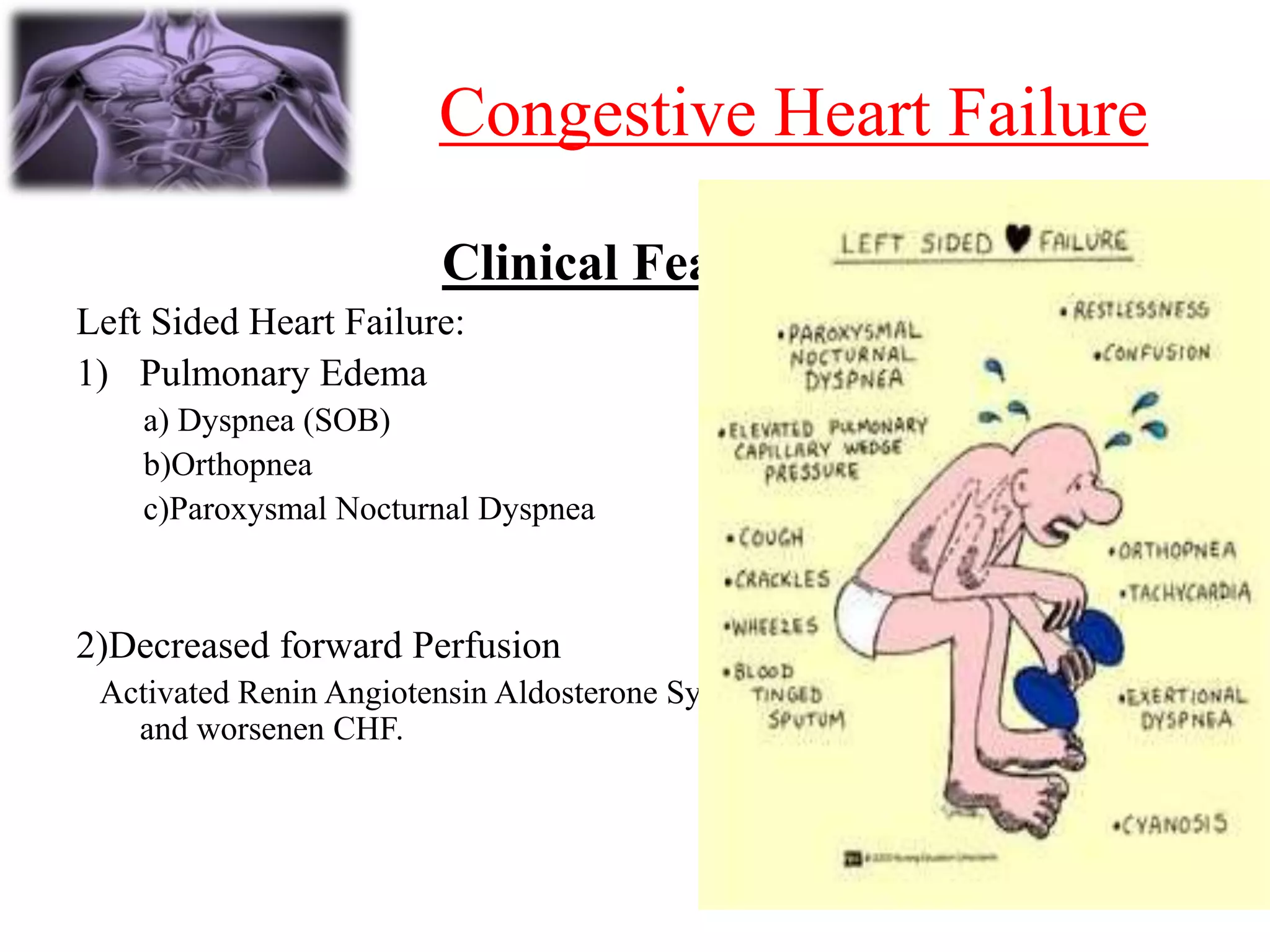 Congestive cardiac Failure | PPTX