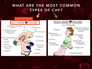 Congestive Heart Failure Case Presentation | PDF