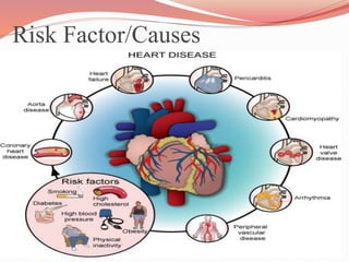 Risk Factor/Causes
 