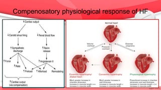 Compenosatory physiological response of HF
 