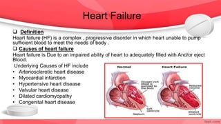 Heart Failure
 Definition
Heart failure (HF) is a complex , progressive disorder in which heart unable to pump
sufficient blood to meet the needs of body .
 Causes of heart failure
Heart failure is Due to an impaired ability of heart to adequately filled with And/or eject
Blood.
Underlying Causes of HF include
• Arteriosclerotic heart disease
• Myocardial infarction
• Hypertensive heart disease
• Valvular heart disease
• Dilated cardiomyopathy
• Congenital heart disease
 