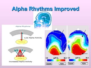 Alpha Rhythms Improved 