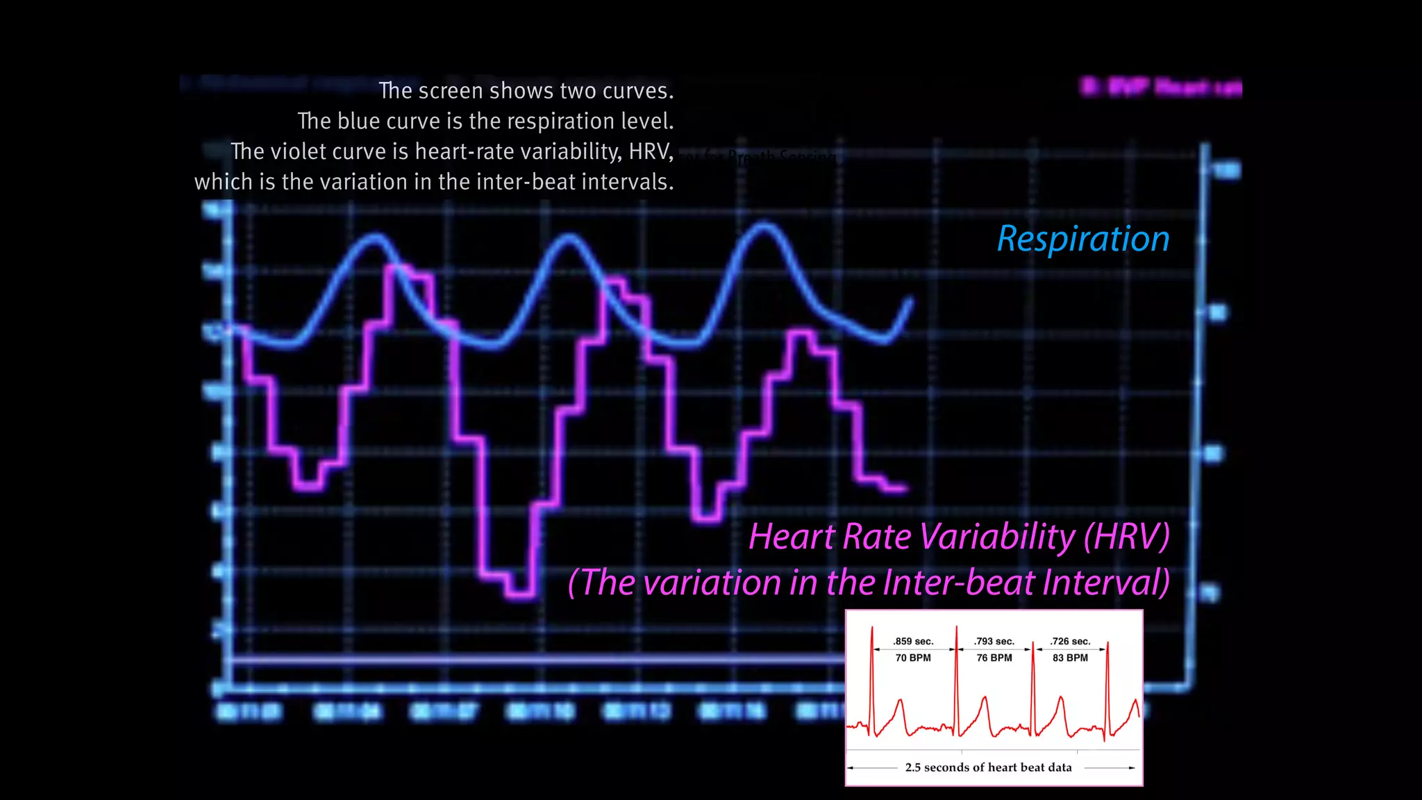 Stretch Sensor for Breath Sensing
Respiration
Heart Rate Variability (HRV)
(The variation in the Inter-beat Interval)
The screen shows two curves.
The blue curve is the respiration level.
The violet curve is heart-rate variability, HRV,
which is the variation in the inter-beat intervals.
 