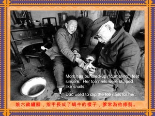 娘六歲纏腳，指甲長成了蝸牛的樣子，爹常為他修剪。  Mom has bundled-up (“dumpling”) feet since 6.  Her toe nails were shaped like snails. Dad used to clip the toe nails for her. 