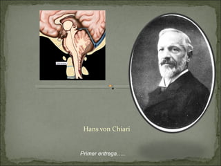 Hans von Chiari Primer entrega….. 