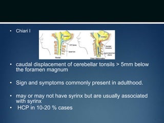 • Chiari I
• caudal displacement of cerebellar tonsils > 5mm below
the foramen magnum
• Sign and symptoms commonly present in adulthood.
• may or may not have syrinx but are usually associated
with syrinx
• HCP in 10-20 % cases
 
