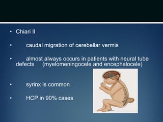 • Chiari II
• caudal migration of cerebellar vermis
• almost always occurs in patients with neural tube
defects (myelomeningocele and encephalocele)
• syrinx is common
• HCP in 90% cases
 