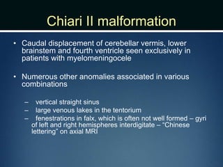 Chiari II malformation
• Caudal displacement of cerebellar vermis, lower
brainstem and fourth ventricle seen exclusively in
patients with myelomeningocele
• Numerous other anomalies associated in various
combinations
– vertical straight sinus
– large venous lakes in the tentorium
– fenestrations in falx, which is often not well formed – gyri
of left and right hemispheres interdigitate – “Chinese
lettering” on axial MRI
 