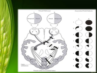 Chiasma | PPTX