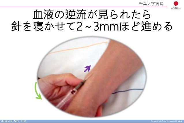 研修医ガイダンス 末梢静脈ライン確保