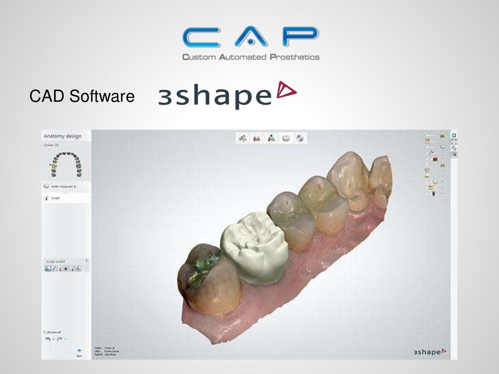 How to select the CAD/CAM system that's right for your lab