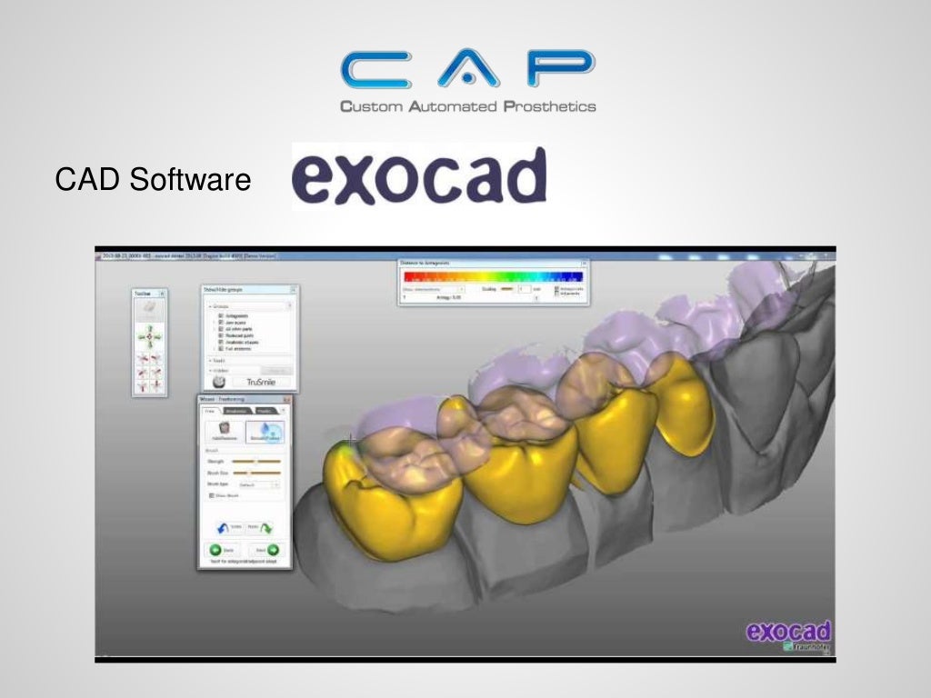 How to select the CAD/CAM system that's right for your lab