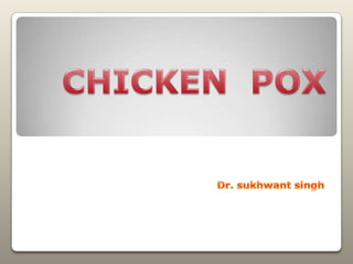 CHICKEN  POX Dr. sukhwantsingh 