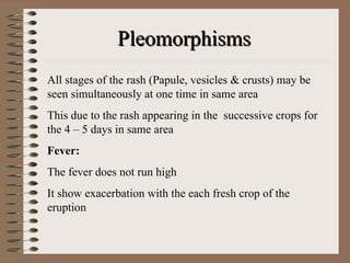 Pleomorphisms
All stages of the rash (Papule, vesicles & crusts) may be
seen simultaneously at one time in same area
This due to the rash appearing in the successive crops for
the 4 – 5 days in same area
Fever:
The fever does not run high
It show exacerbation with the each fresh crop of the
eruption
 
