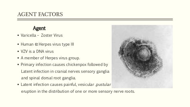 Chicken pox research paper