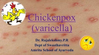 Chickenpox
(varicella)
Dr. Rajalekshmy.P.R
Dept of Swasthavritta
Amrita School of Ayurveda 1
 